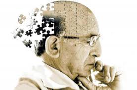 alzheimer