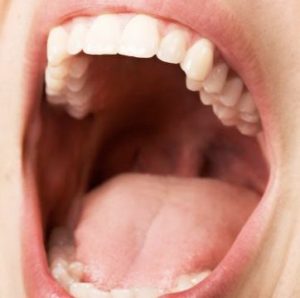 lengua